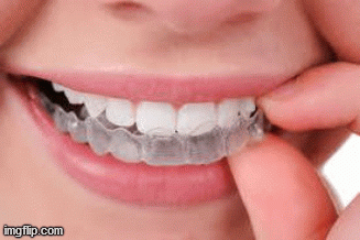 For clear braces in Shadyside, PA visit Shadyside Orthodontics treatment center. Dr. Maria is certified and expert in all kinds of orthodontics and also deal in braces. She is a member of AAO & certified ABO dentist. For free consultation & appointment, visit our website today. https://www.shadysideorthodontics.com/types-braces/