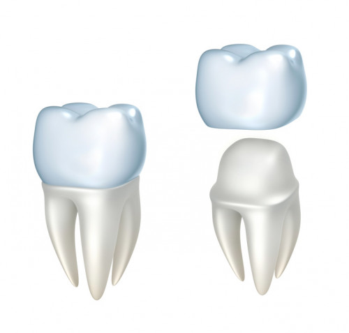 Dental-Crown-Misconceptions-Revealing-The-Tooth.jpg