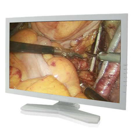 Endoscopy-surgical-monitor.jpg