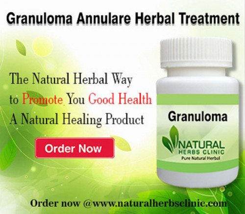 ‍The major organ of the body, the skin is susceptible to a number of dissimilar situation and matters. One such situation is granuloma annulare. Natural Remedies for Granuloma Annulare contains equally external and internal applications... https://naturalherbsclinic.webflow.io/natural-remedies-for-granuloma-annulare