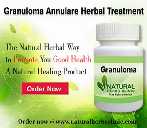 The herbal formulas are extremely safe and successful for Herbal Treatment for Granuloma Annulare Treatment, with no known symptoms... http://naturalherbsclinic.altervista.org/natural-remedies-for-granuloma-annulare/