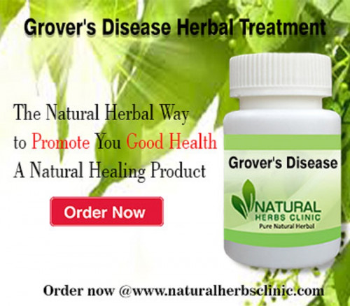 Here are common Natural Remedies for Grover’s Disease that might assist you in finding out a few alleviations and deal with your situation in a better technique... https://groversskindisorder.blogspot.com/2017/06/grovers-disease-natural-remedies.html