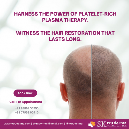 PRP-Hair-Treatment-in-Sarjapur-Road-Bangalore-at-SK-Truderma.png