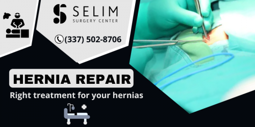 Selim Surgery Center provides professional hernia repair treatment with the laparoscopic procedure and quickly recovers you to get back to your life. For more information, mail us at contact@selimsurgerycenter.com.