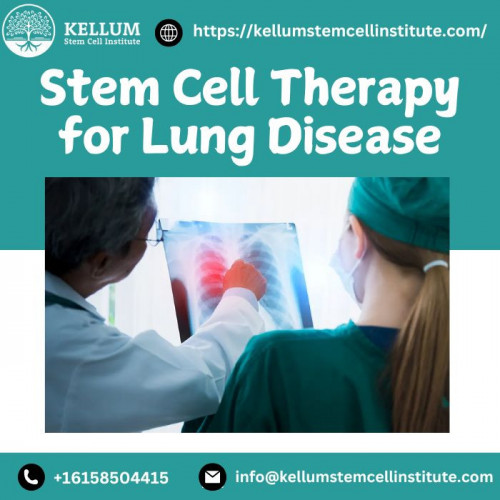 Stem Cell Therapy for Lung Disease