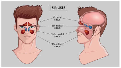 Have you ever felt a severe headache while lowering down your head?? Or heavy headedness??

Well, Sinusitis could be the reason for these issues. 

Sinusitis is a rhinogenic in origin, dental infection, or ear infection. Because of the recurrent infection of the upper respiratory tract, Sinusitis can be very problematic and serious. 

Endoscopic treatment is one of the most efficient ways of treating sinus problems nowadays. It is one of the easiest methods as well and that too with a great success rate. For more details about the endoscopy treatment and its equipment, contact us at +31-85-7608110. You can also visit my website http://diasurge.com.