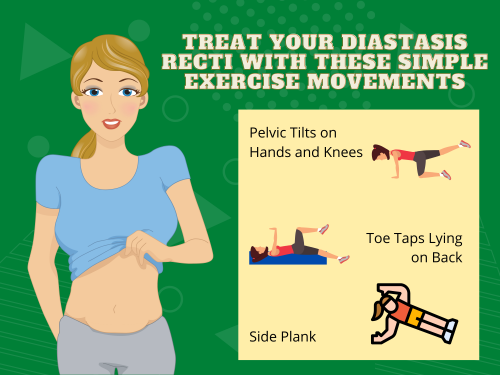 Treat-Your-Diastasis-Recti-With-These-Simple-Exercise-Movements.png