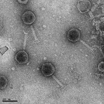 bacteriophages-virus.jpg