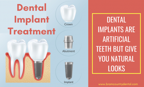 dental-Implant-treatment-brampton.png