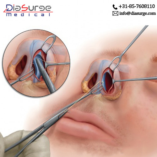 Septoplasty is a surgical procedure which is used to straighten the septum of the nose. Septum divides the bone and the cartilage between the two nostrils. 
visit more:-https://bit.ly/2Nn8UXw