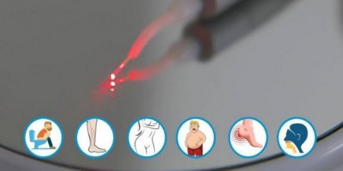 Here again, Laser360Clinic comes in handy as it guarantees all the advantages of laser surgery to the patients.
https://laser360clinic.com/5-things-to-remember-while-finding-a-successful-laser-clinic/