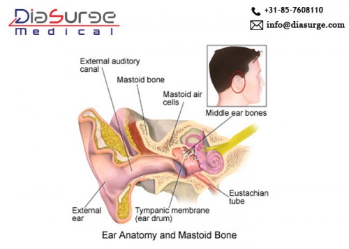 Mastoidectomy is an endoscopic surgical procedure which is performed through endoscopic instruments, suction irrigation pump, and surgical monitor. In this procedure, mastoid air cells are removed when they start causing problems such as vertigo, deadness, and meningitis.